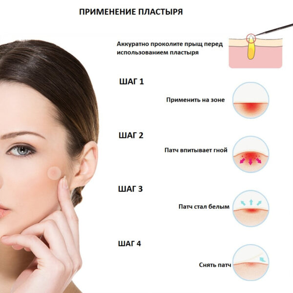 Пластырь от прыщей Acne Patch