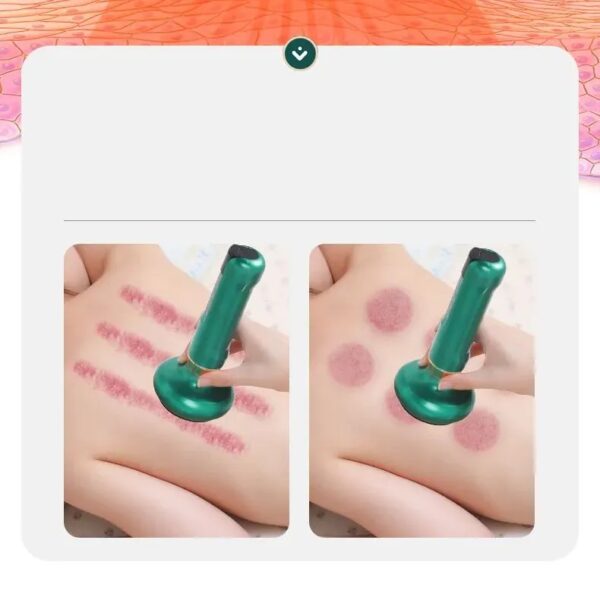 Вакуумный антицеллюлитный массажер для тела массаж гуашью Cupping Massager GREEN